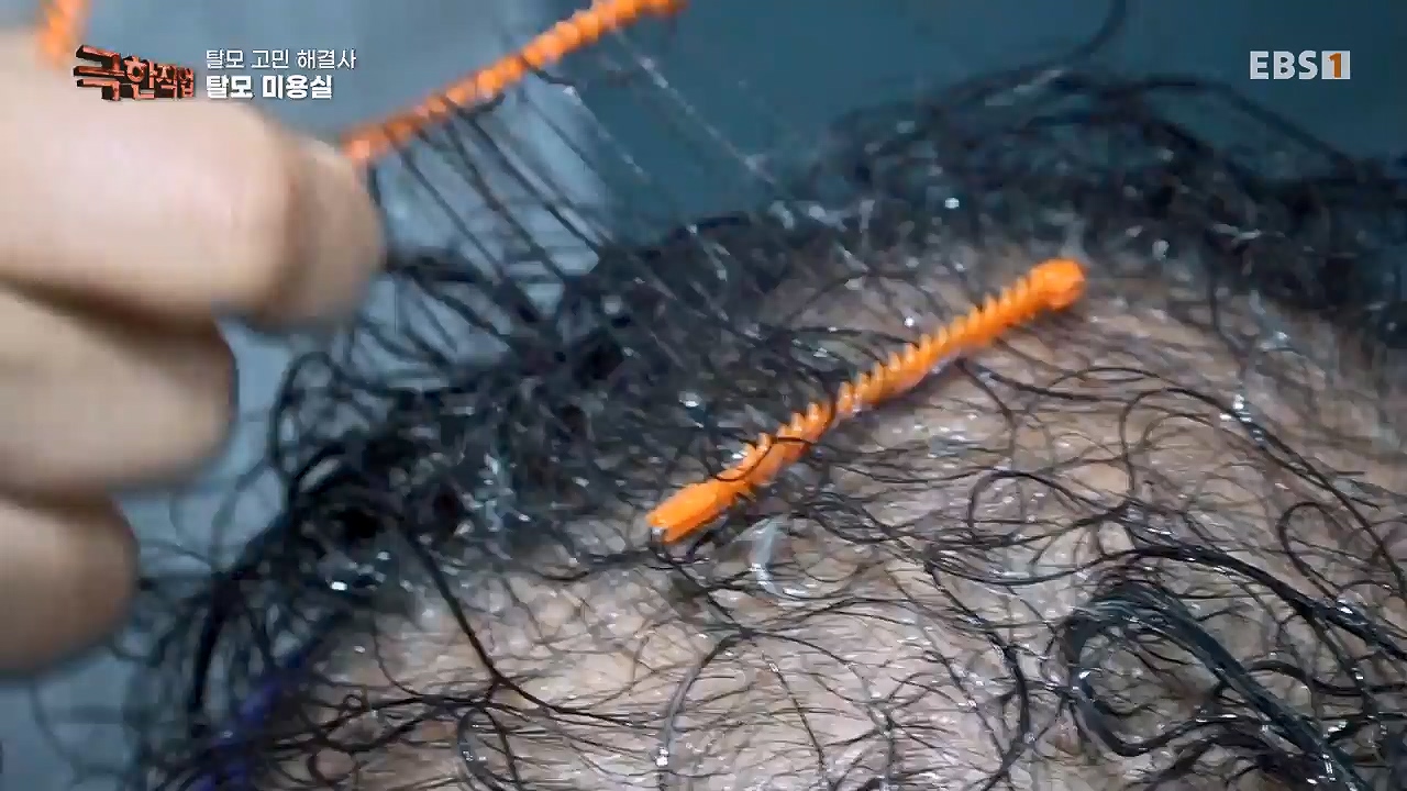 TV - 전 국민의 평생학교 EBS탈모 고민 해결사.mp4_20230508_195812.362.jpg