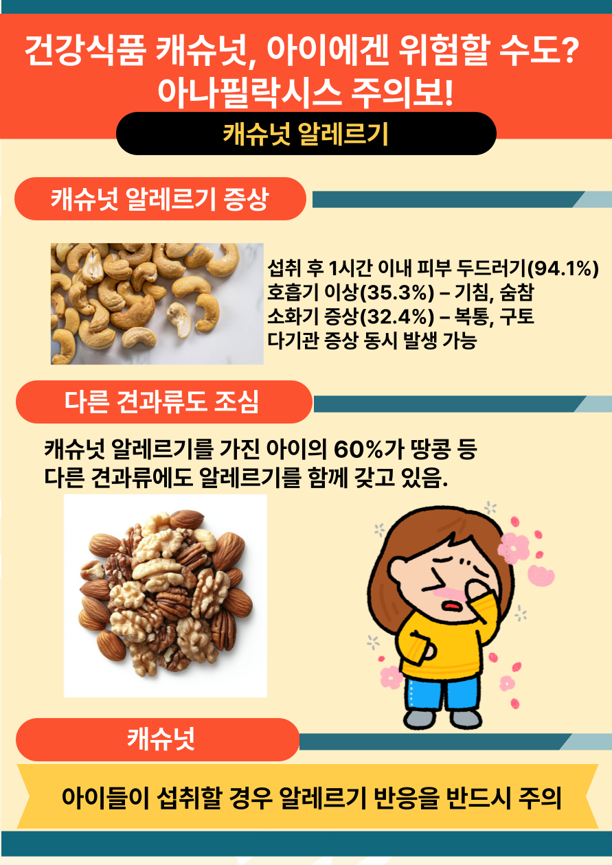 건강식품 캐슈넛, 아이에겐 위험할 수도? 아나필락시스 주의보!