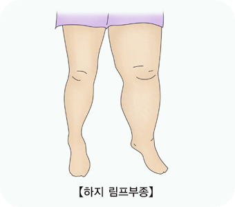 간수치가-높으면-나타나는-증상