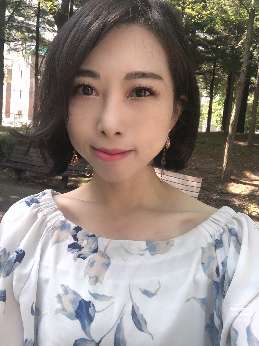 콧볼 축소 비용 [강남/보톡스] 콧볼축소주사-후기 11