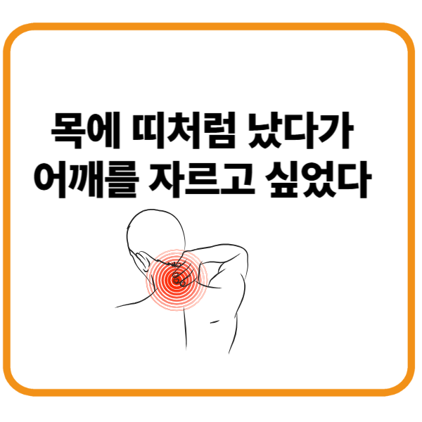 대상포진