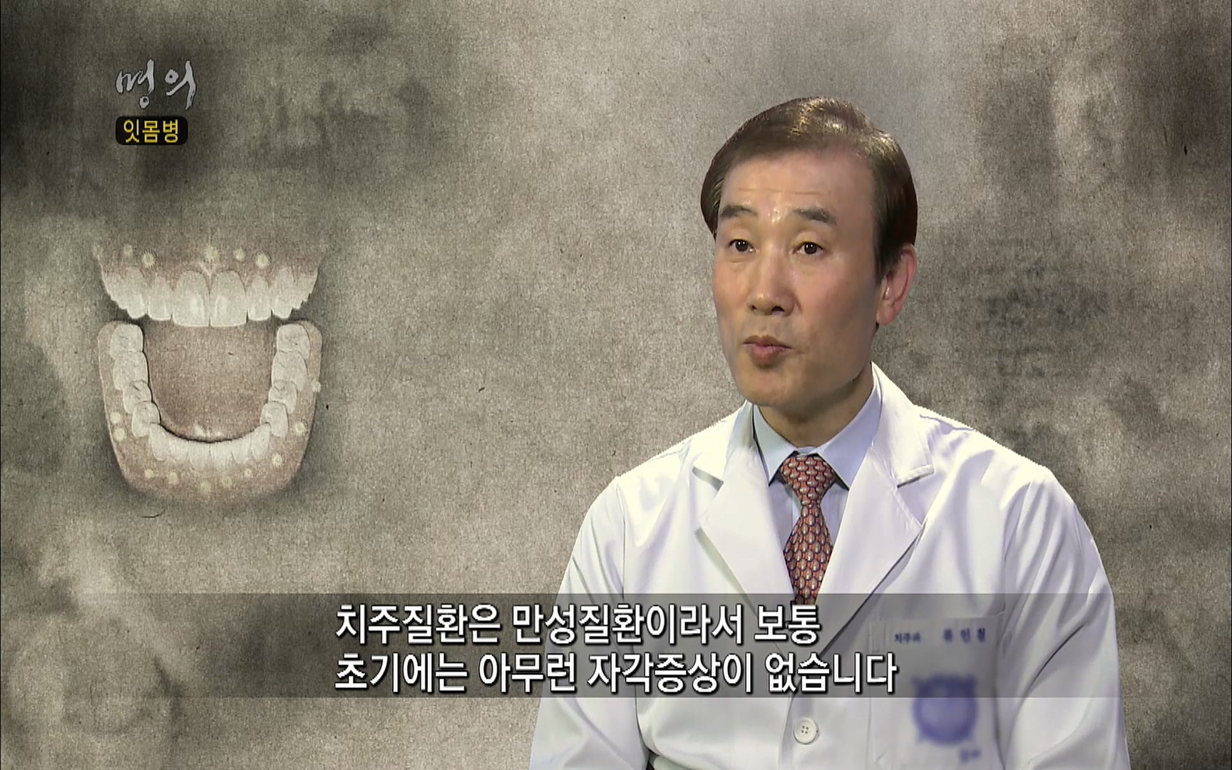 EBS 명의 헬스케어 - TV - 교육의 중심 EBS2015년 1월 16일 (금) 밤 9시 50분, EBS1.mp4_20220505_145402.816.jpg