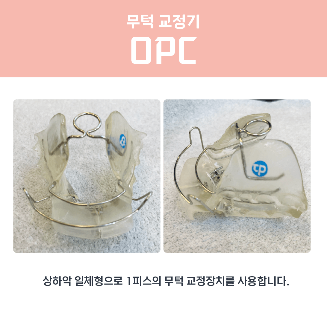 ㅁ무턱-교정-장치-사진-OPC