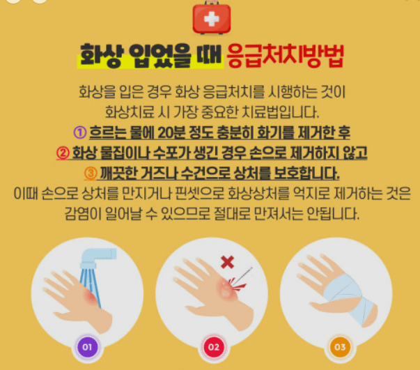 화상 응급처치