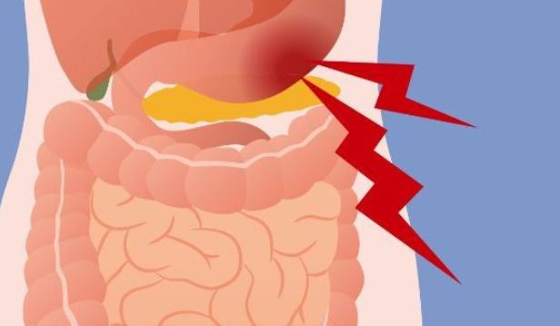  위경련 증상이 있을 때 효과적인 응급처치 방법