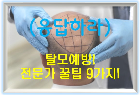 탈모예방! 전문가 꿀팁 9가지