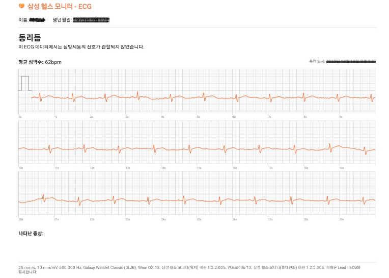 갤럭스 워치로 측정한 심전도 pdf 결과 화면