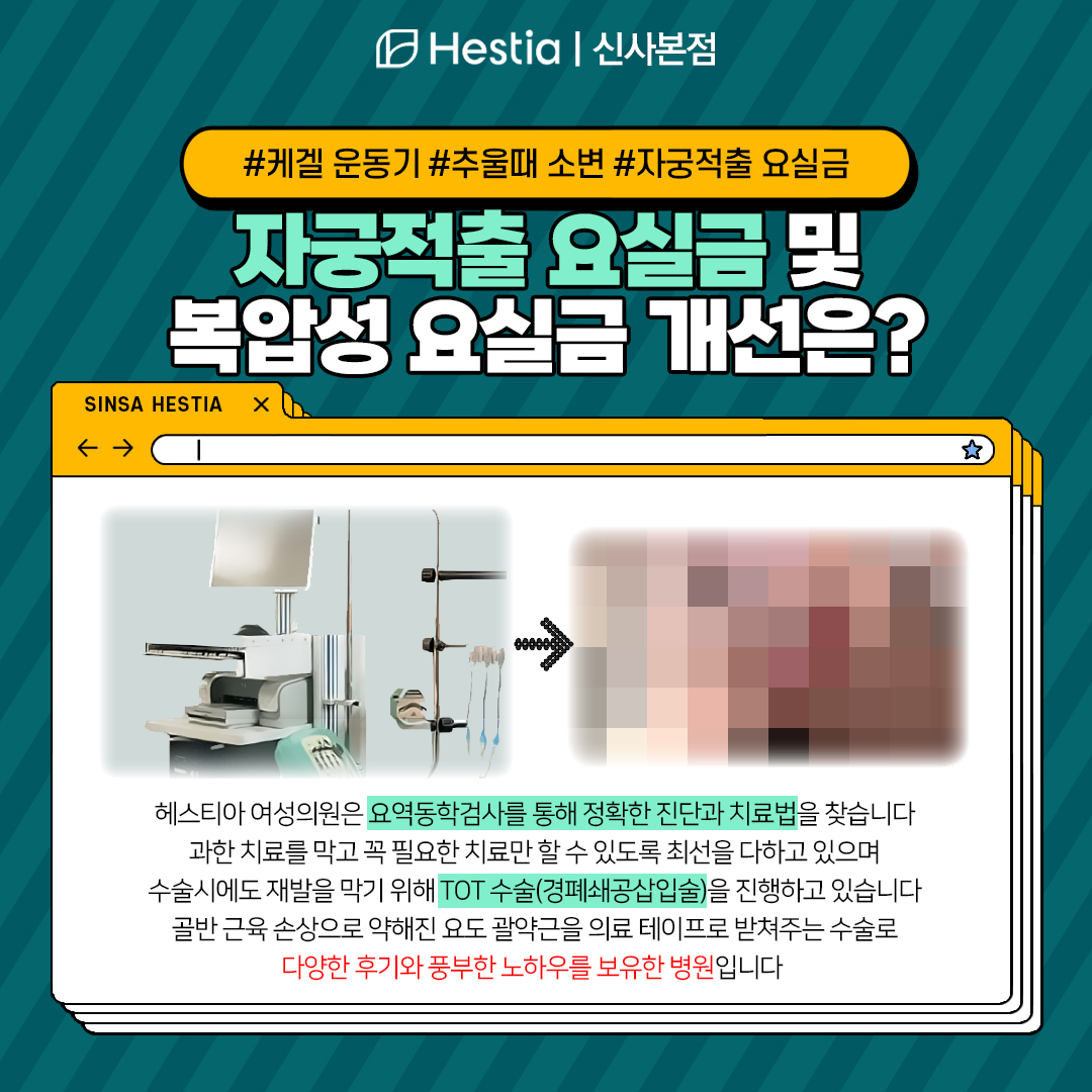 케겔 운동기 추울때 소변 자궁적출 요실금 복압성 요실금? 자궁적출 요실금 재발 없으려면