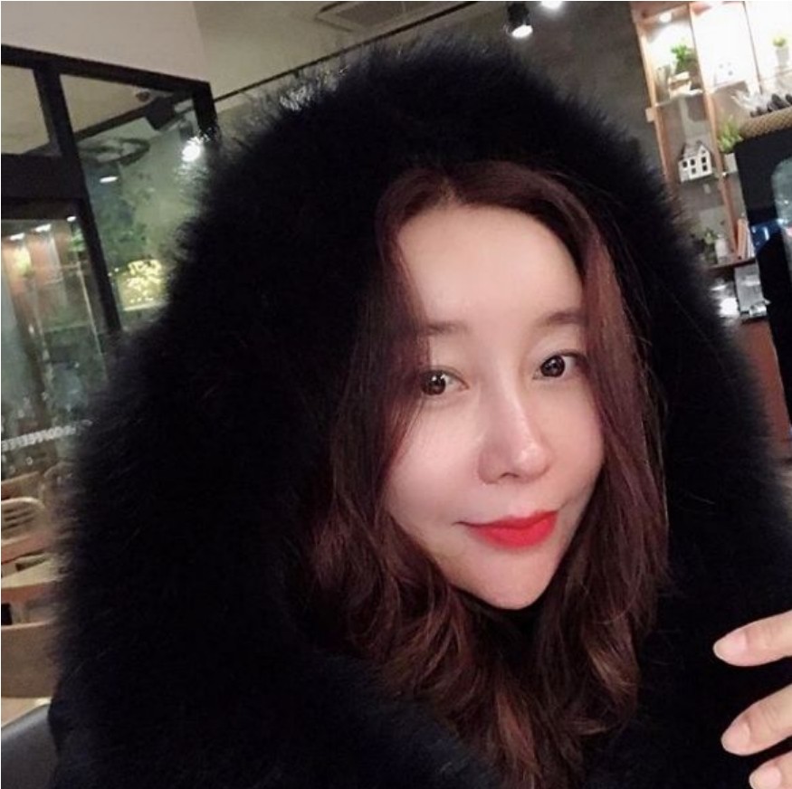  룰라 김지현 과거 얼굴 및 양악 수술 화제
