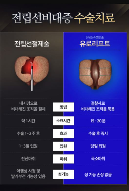 전립선비대증 수술치료