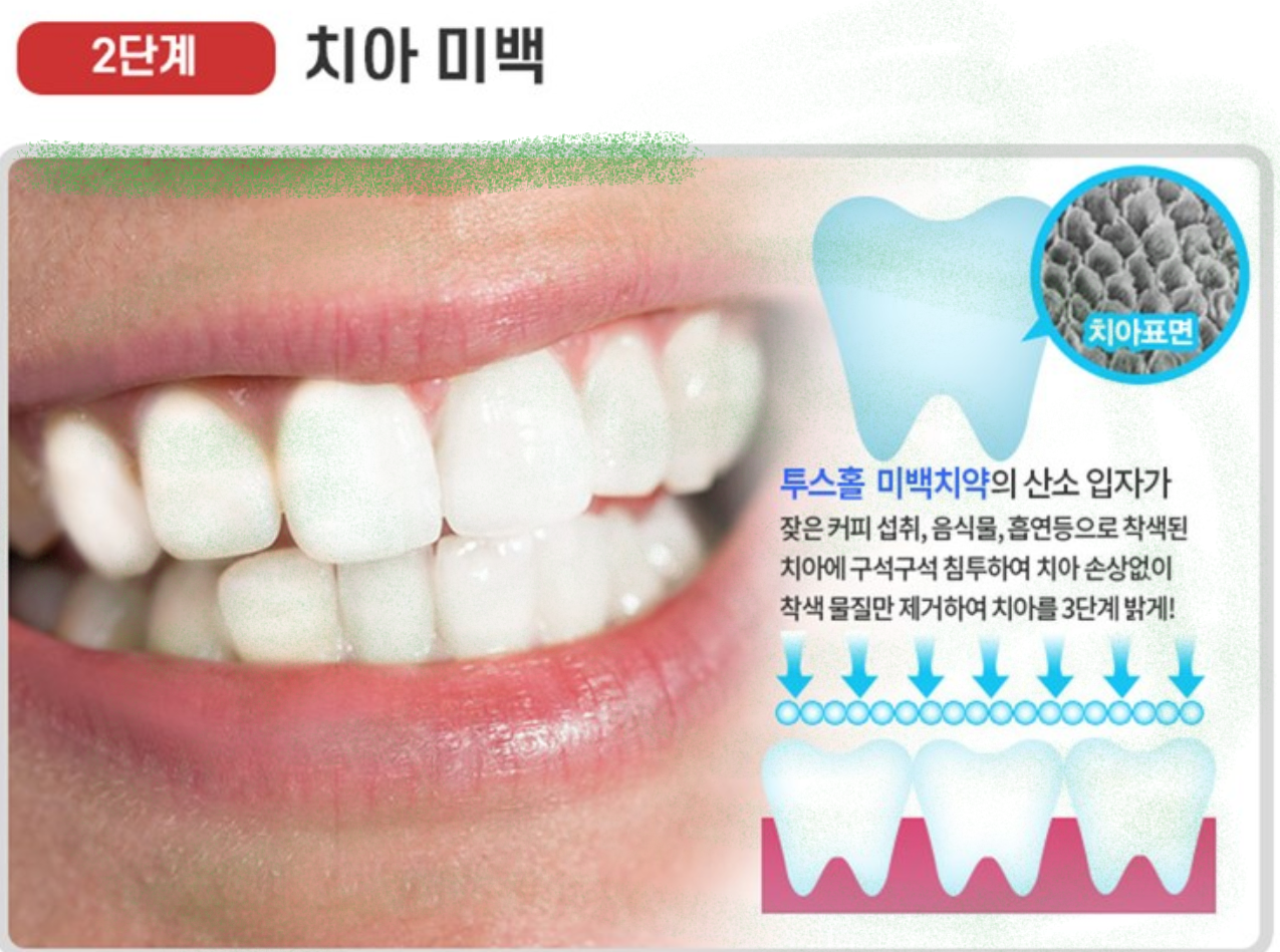  투스홀미백치약과 네이처퓨리 미백치약 기능 분석 및 사용자 후기 모음
