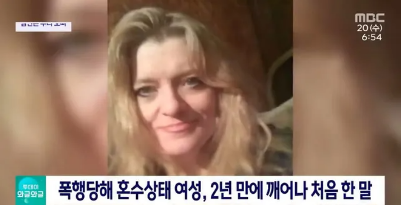  2년동안 혼수상태였던 여성의 충격적인 한마디