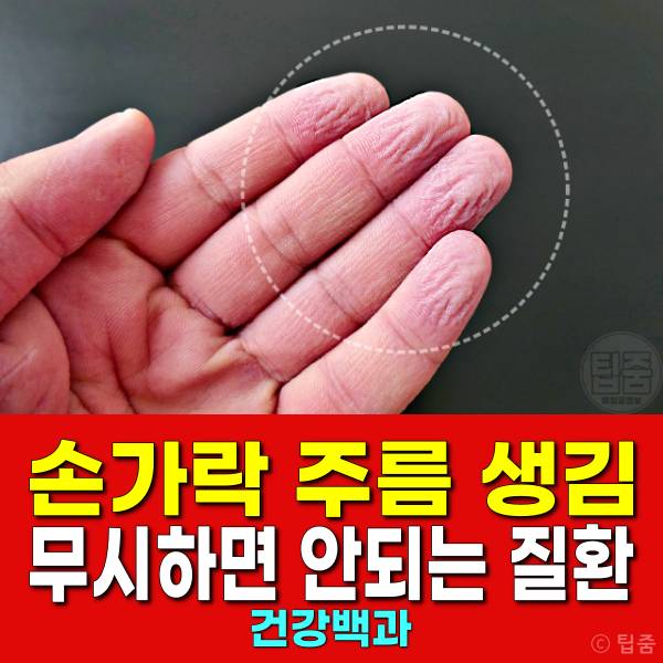 손가락 주름 병 질환 갑상선 탈수증 레이노 루푸스 림프부종 경피증