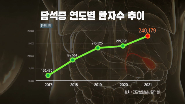 소화불량의 경고 담낭 담도질환 명의