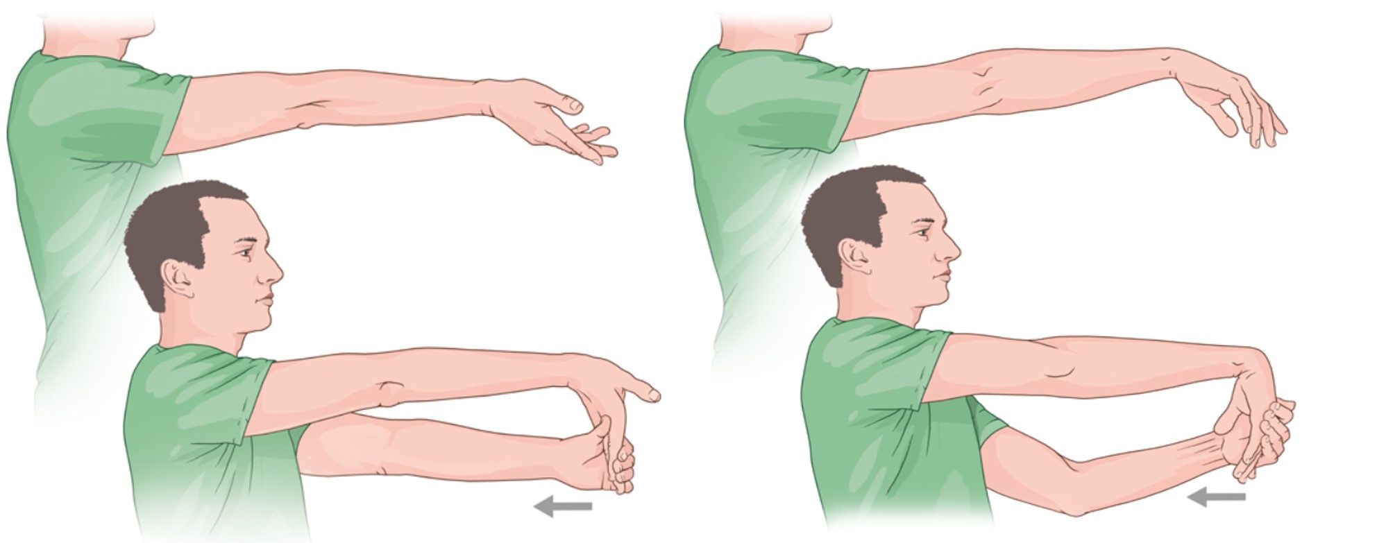 팔꿈치 통증 예방운동