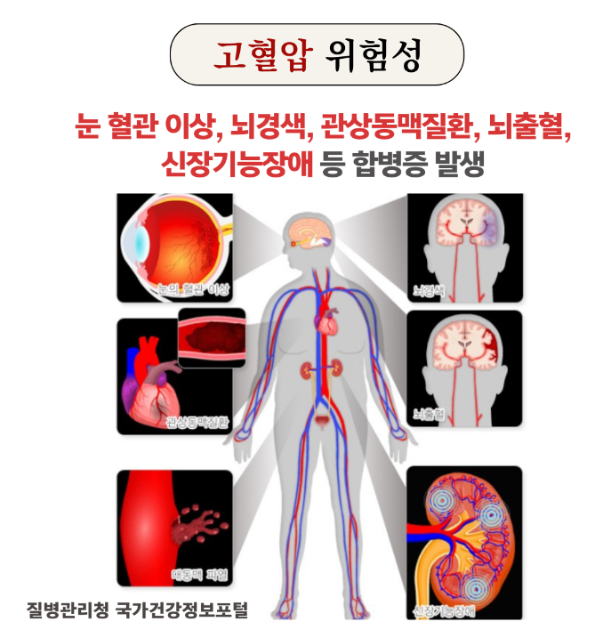 고혈압 위험성(hypertension)
