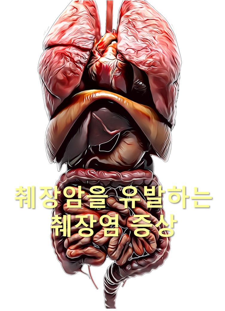  췌장암의 초기 7가지 신호와 췌장암을 유발하는 췌장염 증상