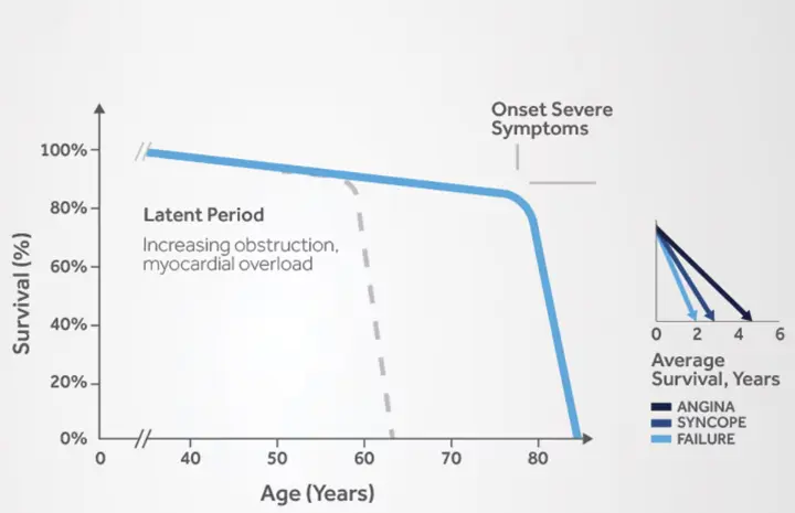 aortic stenosis의 경과와 증상