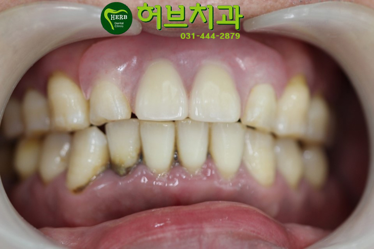 허브치과 이미지