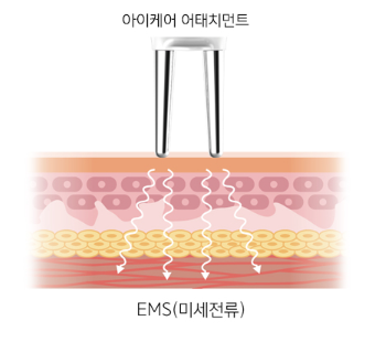 EMS 피부 마사지기(18)
