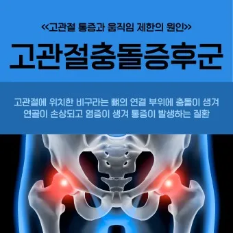 고관절 통증 증상 확인하기_8