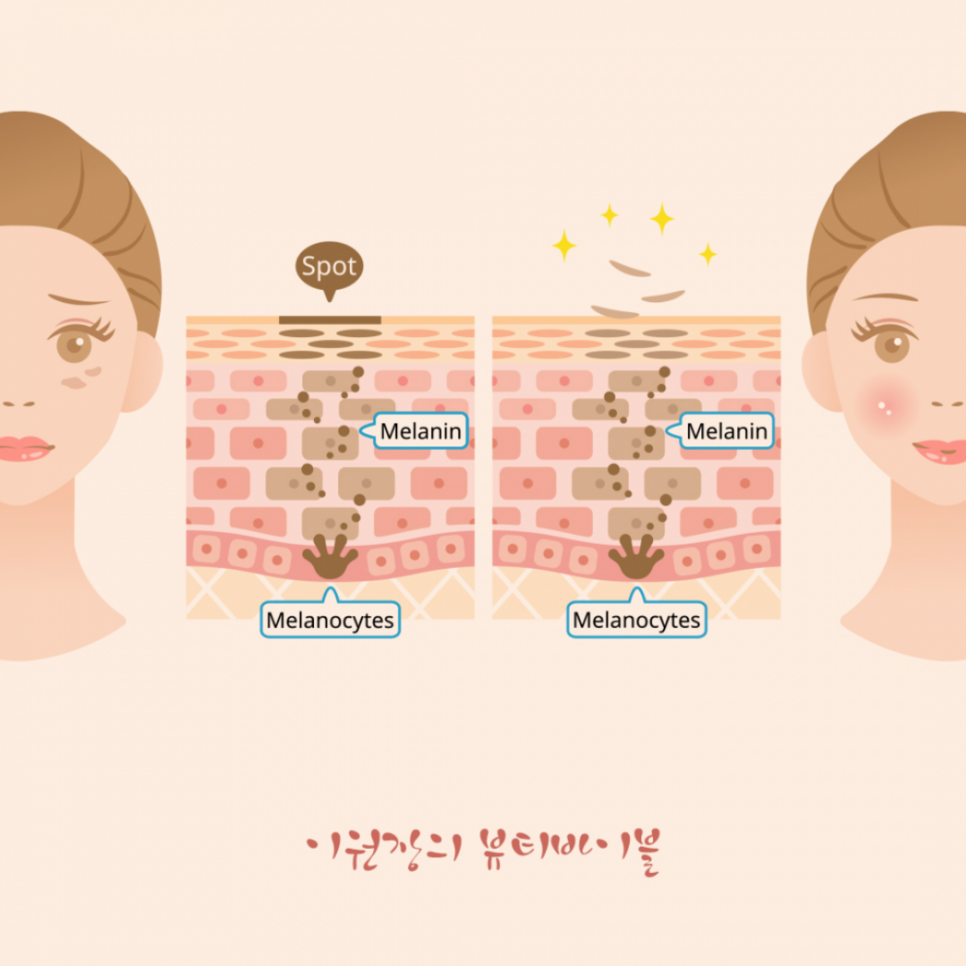 초음파 마사지 효능 초음파마사지 6