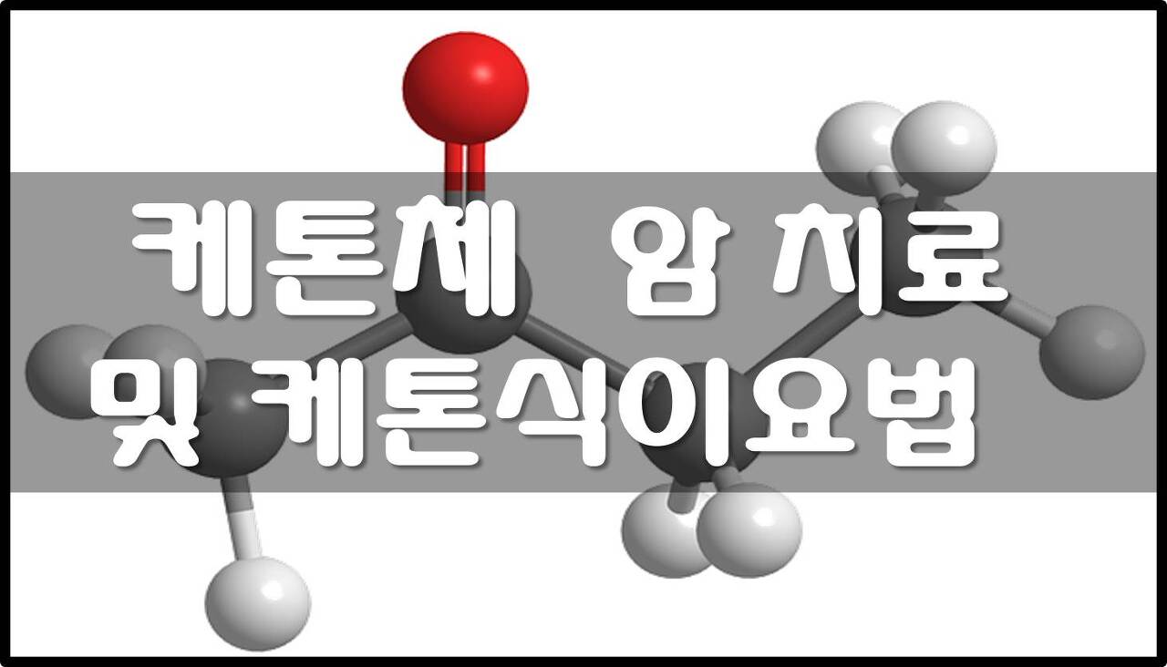  케톤체 - 암치료 및 케톤식이요법