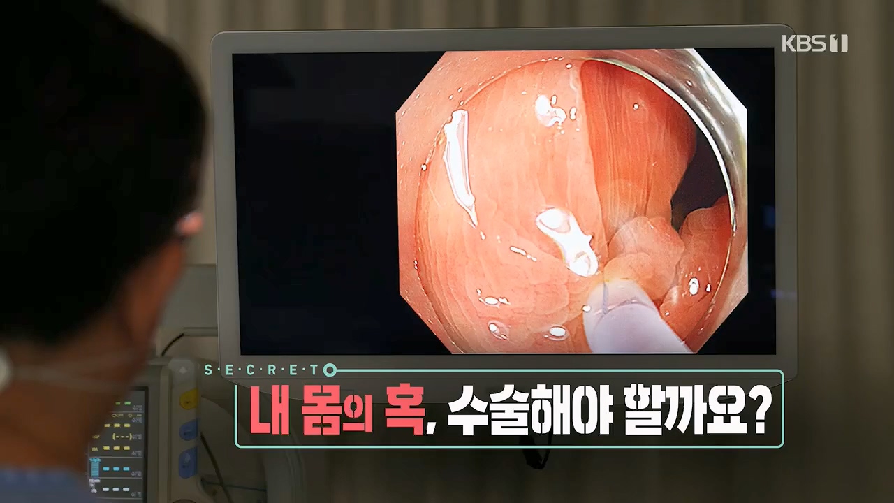 생로병사의 비밀.E870.230532p.H264-F1RST.mp4_20230605_195443.302.jpg
