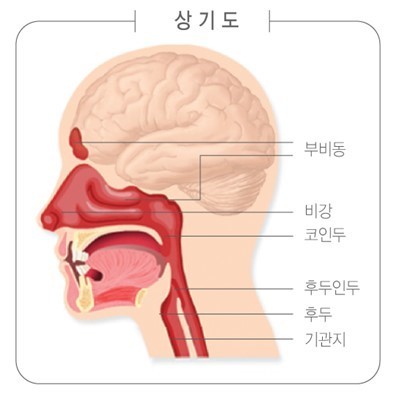  특발성 or 면역 혈소판 감소성 자반증에 대해