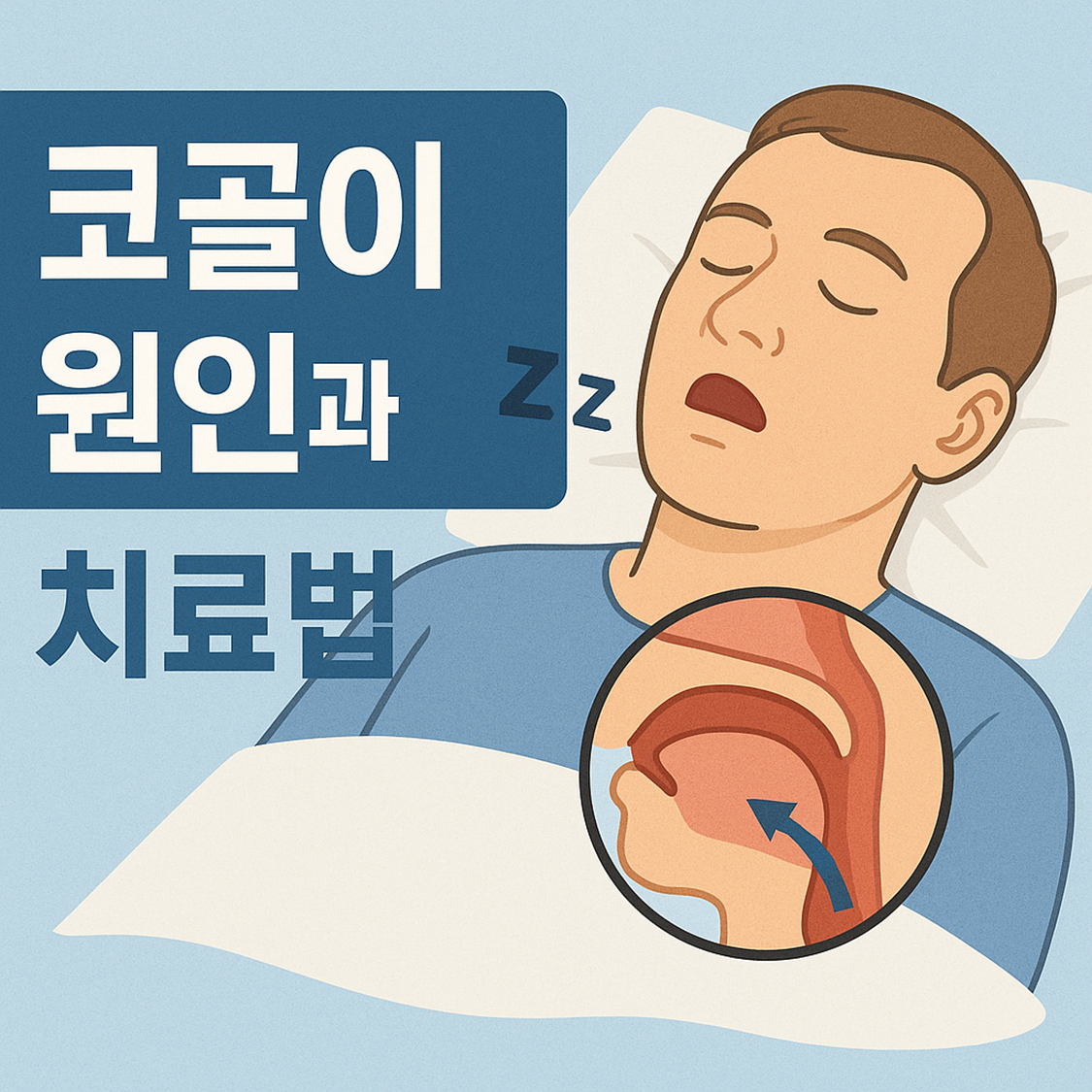 코골이 원인과 치료법