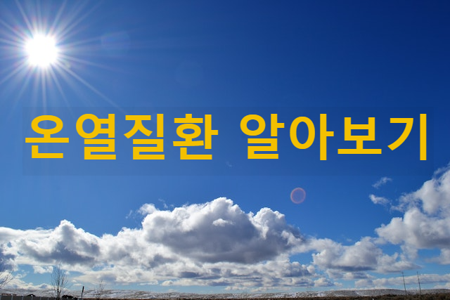  이슈 플러스_최악의 폭염 속 더위 먹었을 때 온열질환 총정리(종류, 증상, 응급조치 방법, 예방)