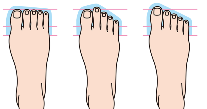 발의 형태 「이집트형」 「그리스형」 「스퀘어형」