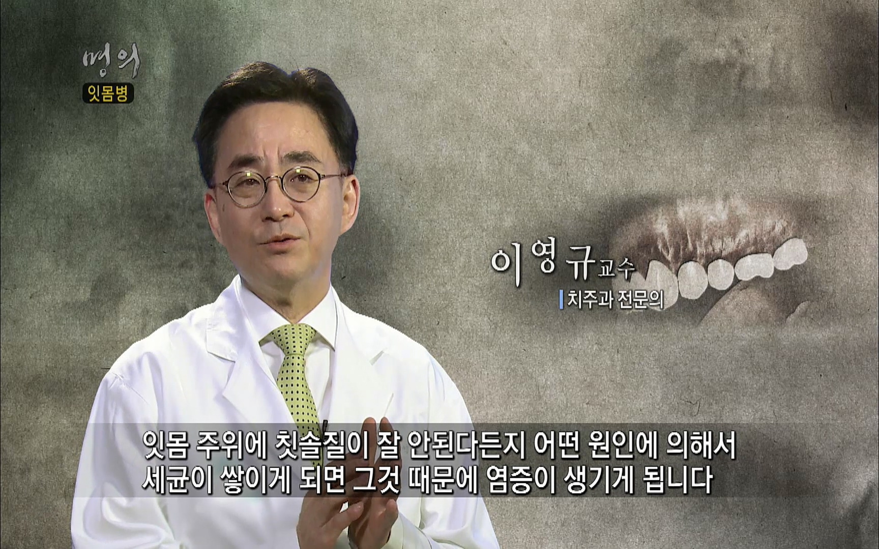 EBS 명의 헬스케어 - TV - 교육의 중심 EBS2015년 1월 16일 (금) 밤 9시 50분, EBS1.mp4_20220505_145117.041.jpg