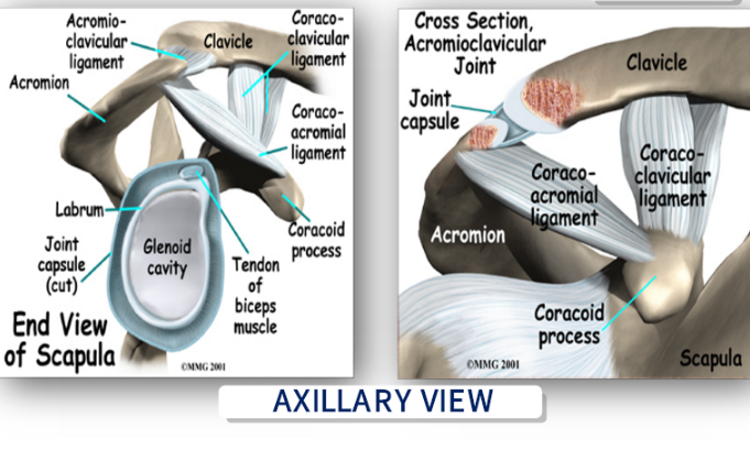 axillary view