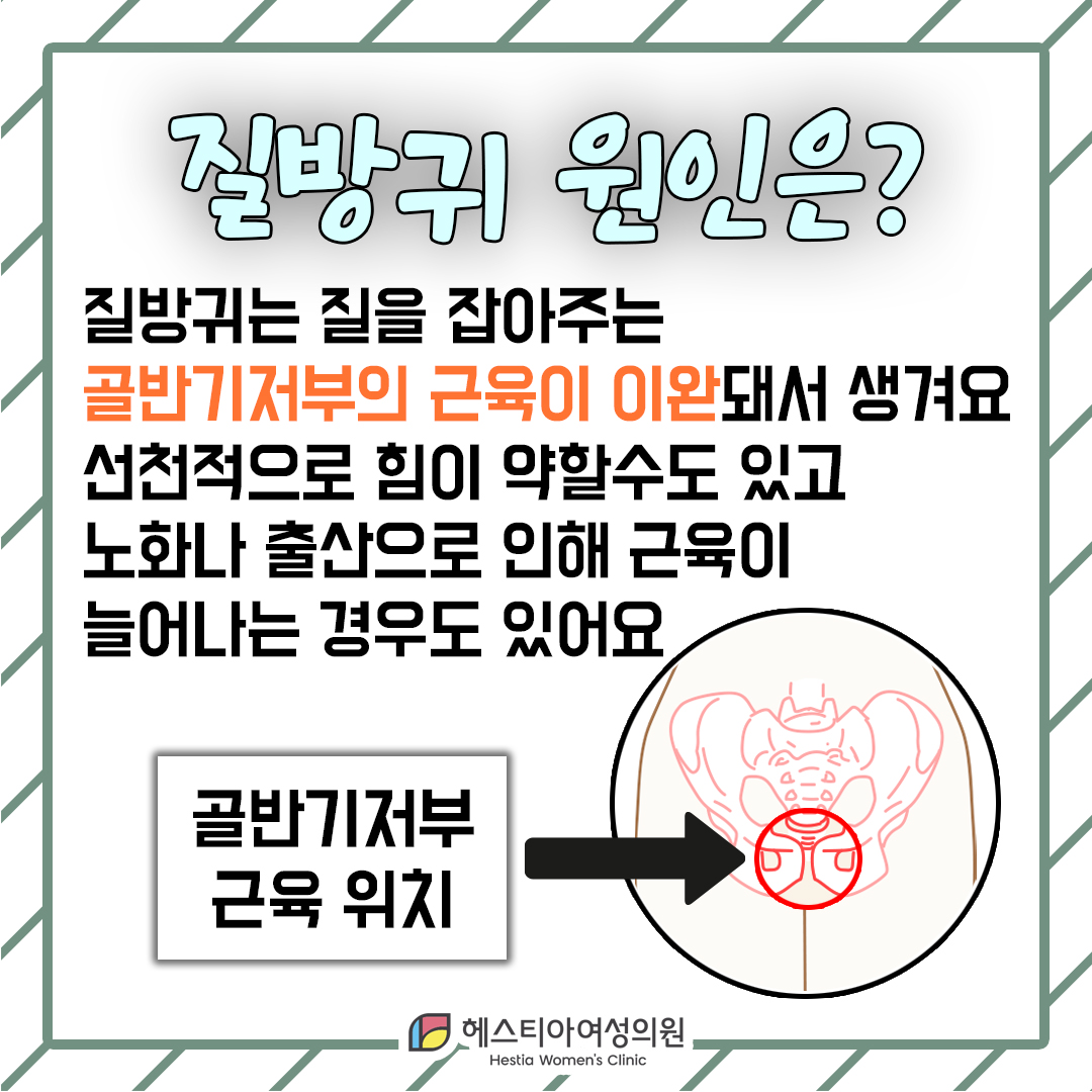 신사동산부인과 관계후 질방귀 질탄력 개선 질방귀 원인이 무엇인가요?
