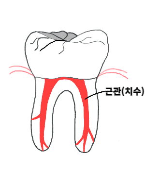 근관 참고사진