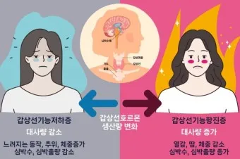 갑상샘 저하증 갑상선 기능저하증 증상 수치 치료_11