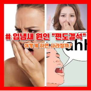 입냄새원인편도결석