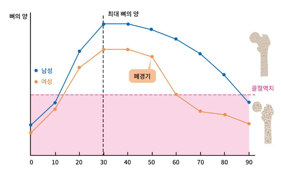 골다공증 원인 증상 골다공증 예방법