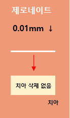 제로네이트 구조