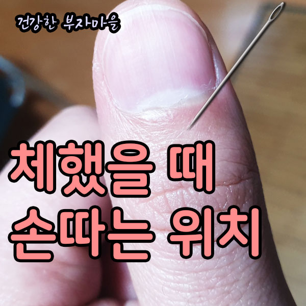 체했을때_손따는_위치