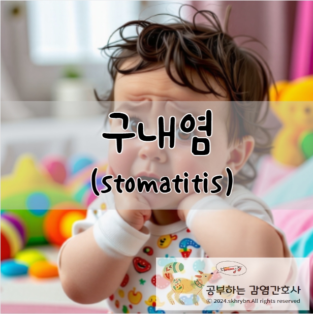 구내염(stomatitis), 아기구내염 원인 및 증상