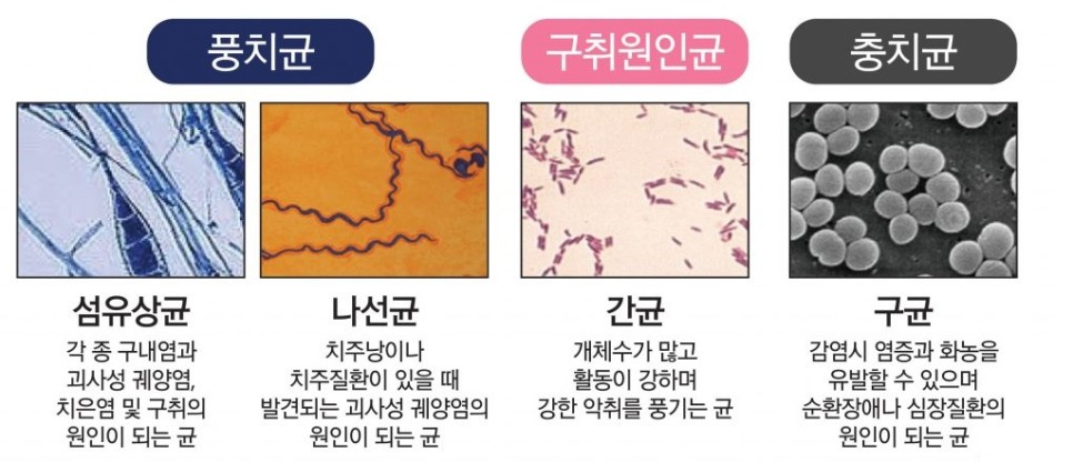  입속 치아 세균의 종류와 치아 세균이 많은 곳