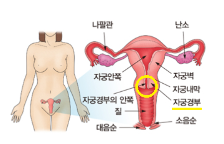 자궁-경부-사진