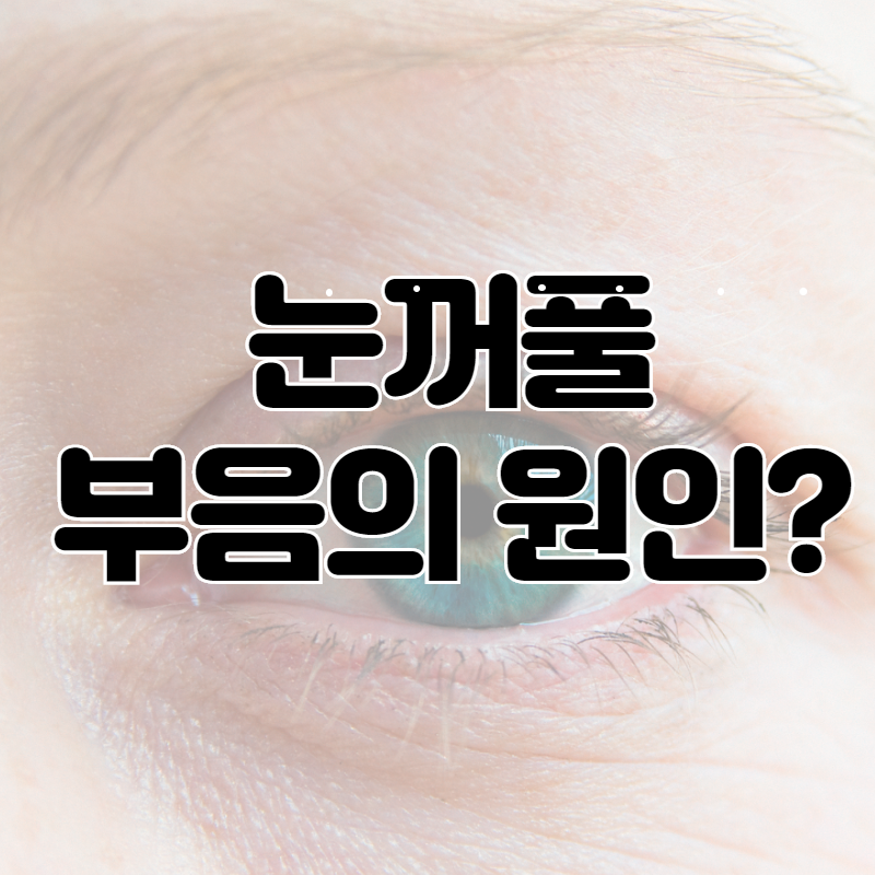  눈꺼풀 부음의 원인은? 12가지 원인 소개합니다!