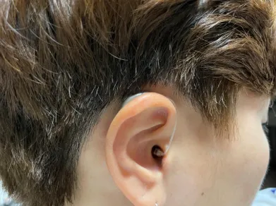보청기 국가보조금지원
