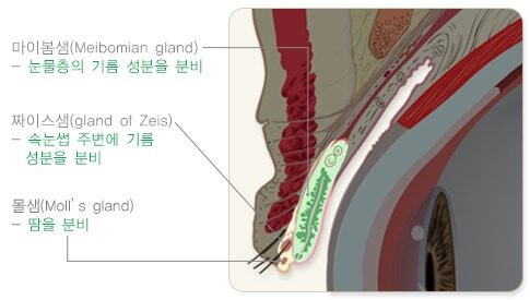 다래끼