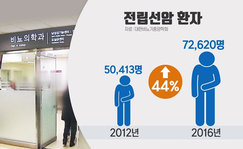  남자 전립선암 증상과 치료 방법