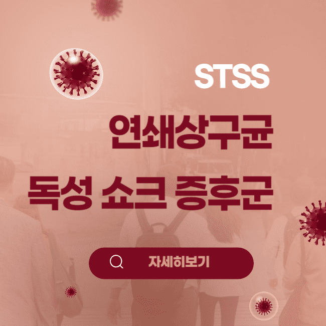 연쇄상구균 독성쇼크증후군 STSS 일본 바이러스 감염병 썸네일