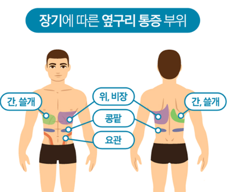 장기에 따른 옆구리 통증 부위